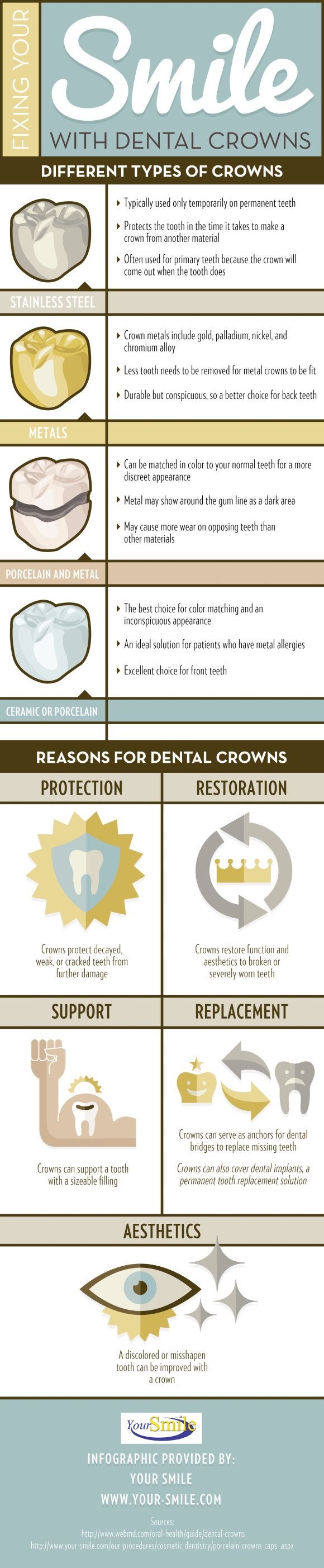 Dental Crowns near Bel Air